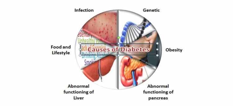 What is the leading cause of diabetes?